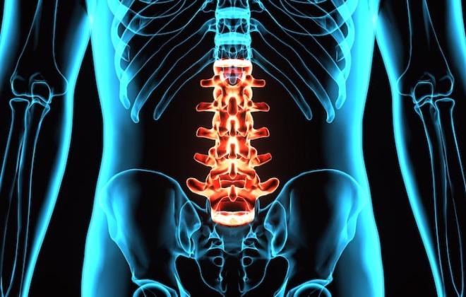 Ten Common Health Complications of Spinal Cord Trauma