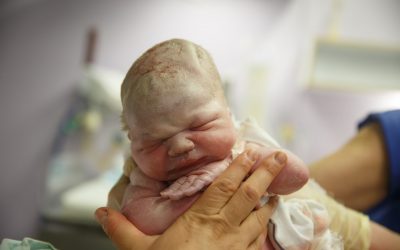 Birth Trauma And Vertebral Subluxations